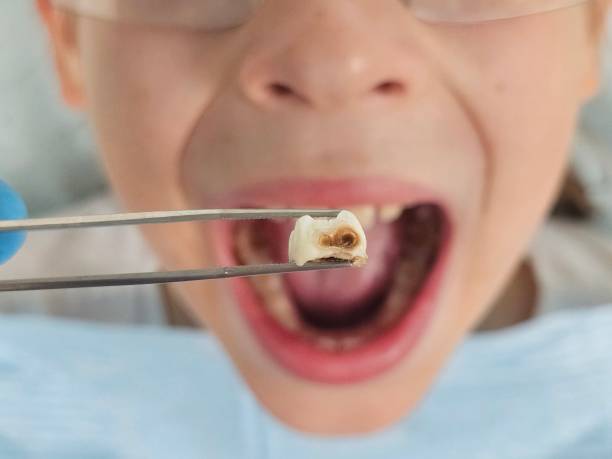 Best Emergency Denture Repair in Decatur, IN